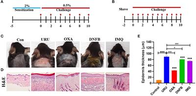 Comparative Study on Different Skin Pruritus Mouse Models